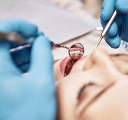 A close up photo of a dental patient getting a hygiene treatment. We see the patient from the point of view of the hygienist, the frame shows the blue-gloved hands of the hygienist as they use a mirror and a curette to check the patient's teeth.