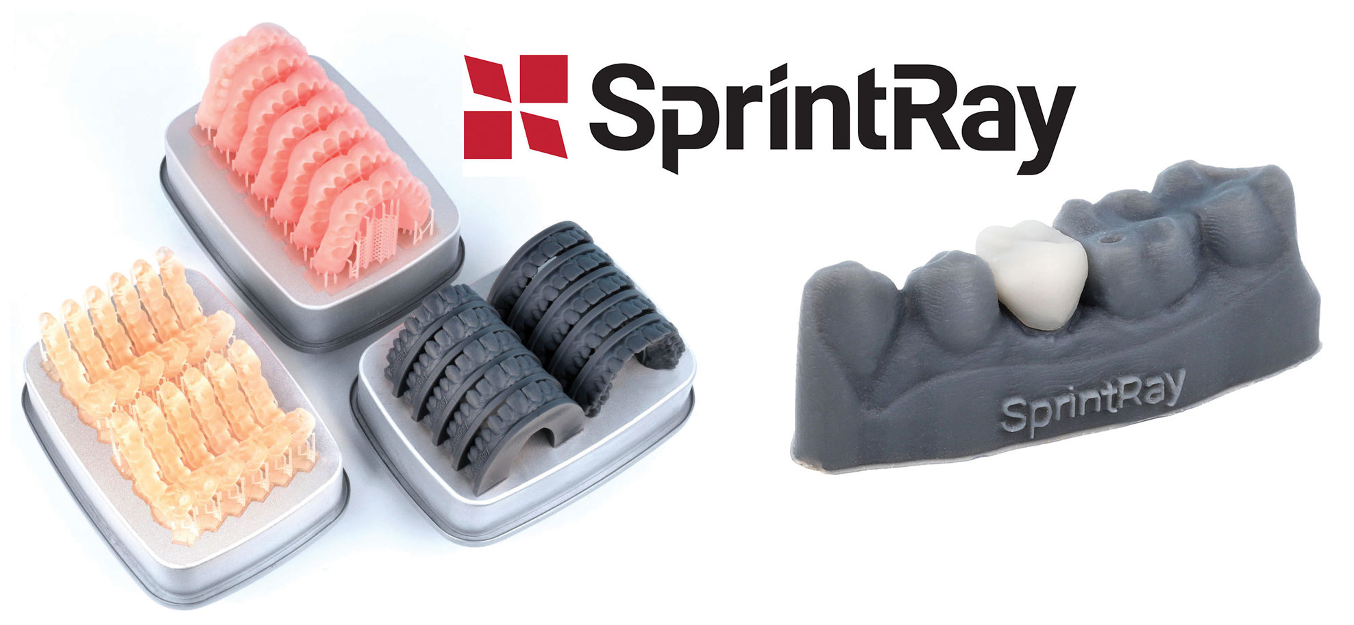 3D printed dental surgical guides and dental bridge