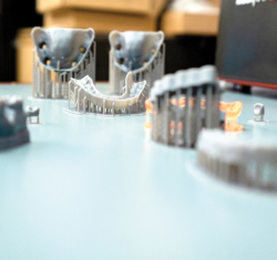 3D Printing – dental surgical guides