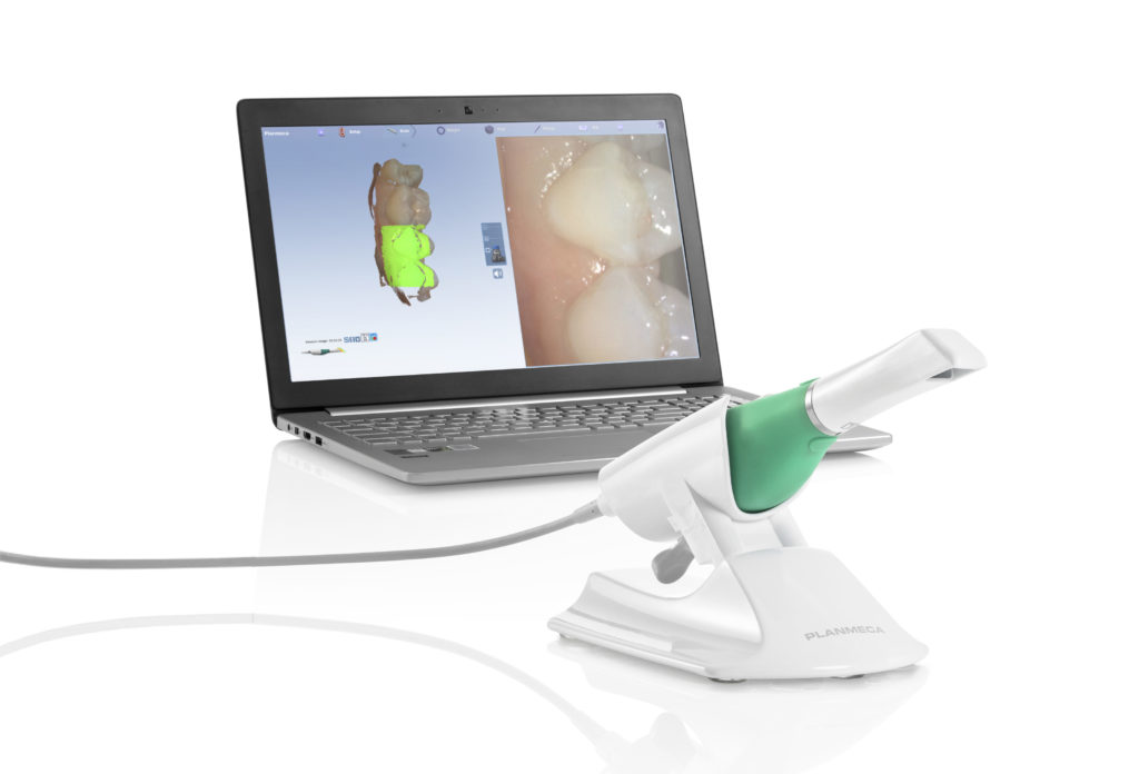 Planmeca Emerald Scanner – New Dental Technology