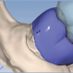  Initial dental design proposal.