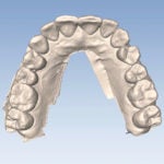 Full-arch dental models.