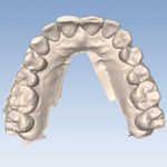 Full-arch dental models.