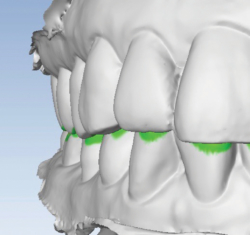 Properly aligned models.