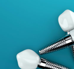 Protect All Around – Teeth/Implants