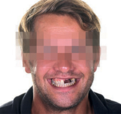 The Special Case – Dr Peter Randelzhofer, Munich, Germany