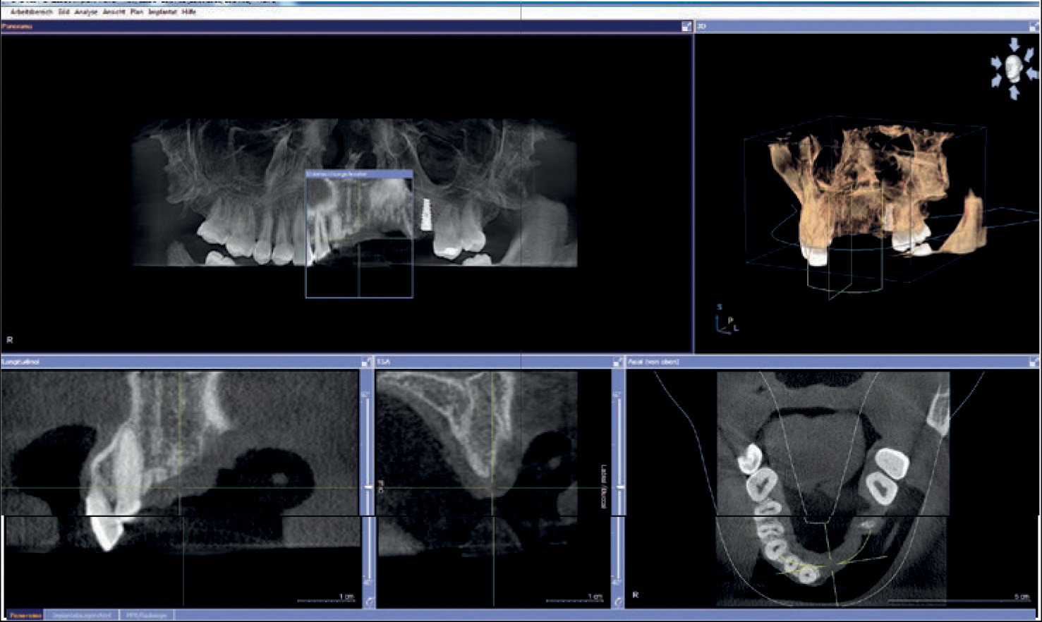 The Special Case – impression, registration, photo documentation for planning of the reconstruction