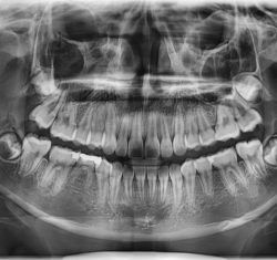 Cone Beam CT: How to Read Scans Like Pans 1