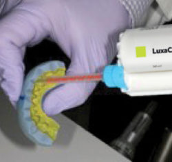 1C – Luxacrown injected into putty matrix and around gingiva to create precise margins and ovate pontics.