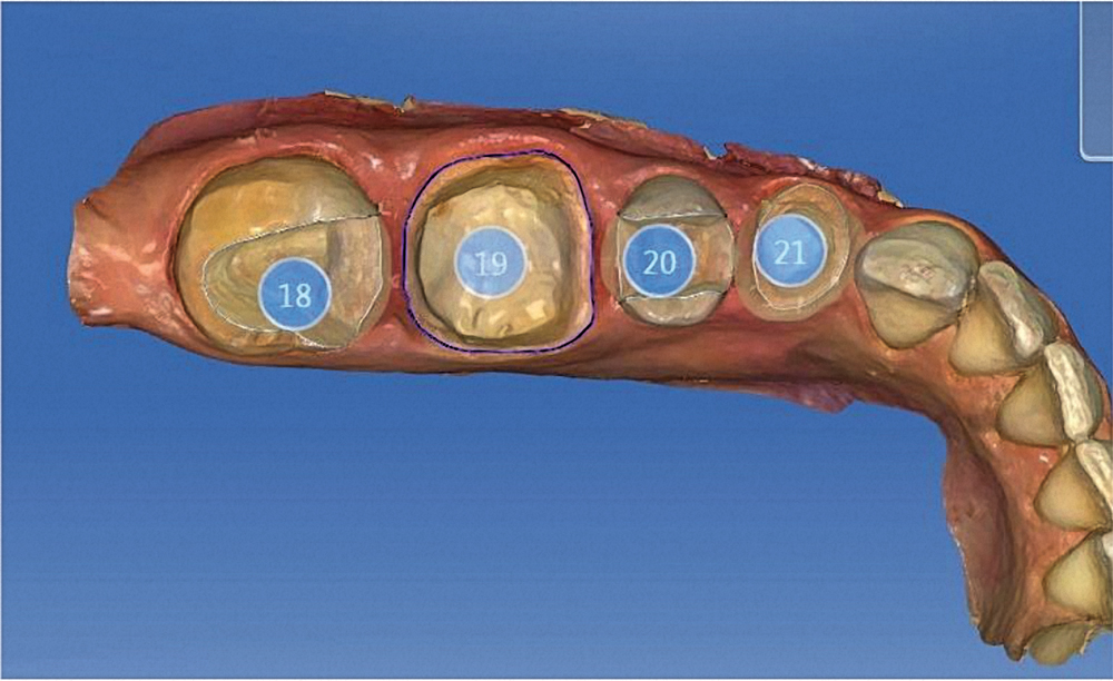 High Performance, Made Brilliant - BRILLIANT Crios - Burkhart