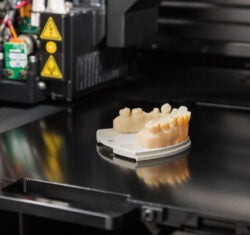 3D Printing: The Future of Dentistry