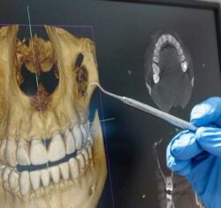 The Practical Benefits of CBCT