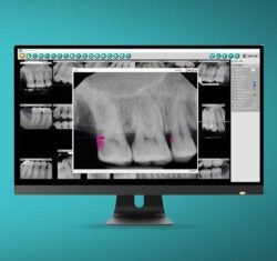 Artificial Intelligence is Shaping the Future of Dentistry